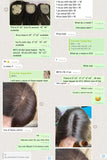 Topper Femme en Cheveux Humains Base Soie – Frange Aérée, Cheveux Européens Remy