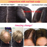 5"X5" Platinum Blonde Silk Top Human Hair Closure Virgin European Human Hair Silk Base Topper with Clips in for Women White #60